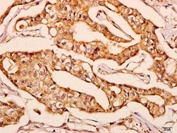 Invitrogen GNPAT Polyclonal Antibody 100 &mu;L; Unconjugated:Antibodies,