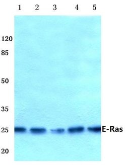 Invitrogen ERAS Polyclonal Antibody 100 &mu;L; Unconjugated:Antibodies,