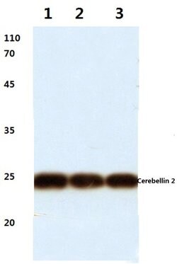 Invitrogen Cerebellin 2 Polyclonal Antibody 100 &mu;L; Unconjugated:Antibodies,