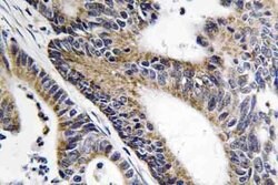 Invitrogen IQCB1 Polyclonal Antibody 100 &mu;L; Unconjugated:Antibodies,