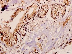 Invitrogen ME3 Polyclonal Antibody 100 &mu;L | Buy Online | Invitrogen&trade; | Fisher Scientific