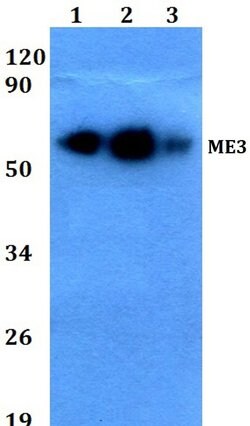 Invitrogen ME3 Polyclonal Antibody 100 &mu;L | Buy Online | Invitrogen&trade; | Fisher Scientific