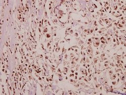 Invitrogen POM121 Polyclonal Antibody 100 &mu;L; Unconjugated:Antibodies,