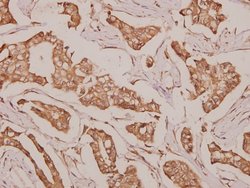 DDX52 Polyclonal Antibody:Antibodies, Polyclonal