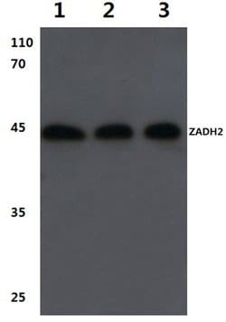 Invitrogen ZADH2 Polyclonal Antibody 100 &mu;L; Unconjugated:Antibodies,