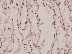 Invitrogen Aquaporin 5 Polyclonal Antibody 100 &mu;L; Unconjugated:Antibodies,
