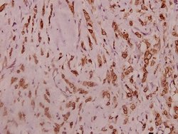 Invitrogen SCN2A Polyclonal Antibody 100 &mu;L | Buy Online | Invitrogen&trade; | Fisher Scientific