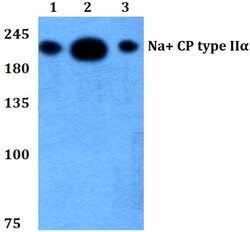 Invitrogen SCN2A Polyclonal Antibody 100 &mu;L | Buy Online | Invitrogen&trade; | Fisher Scientific