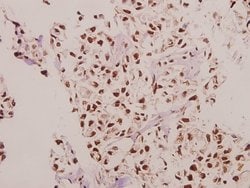Invitrogen CPI-17 Polyclonal Antibody 100 &mu;L; Unconjugated:Antibodies,