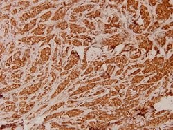 Invitrogen ATP5I Polyclonal Antibody 100 &mu;L; Unconjugated:Antibodies,