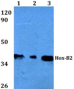 Invitrogen HOXB2 Polyclonal Antibody 100 &mu;L; Unconjugated:Antibodies,