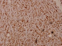 Invitrogen PEX7 Polyclonal Antibody 100 &mu;L; Unconjugated:Antibodies,