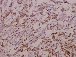 Invitrogen OATP1 Polyclonal Antibody 100 &mu;L | Buy Online | Invitrogen&trade; | Fisher Scientific