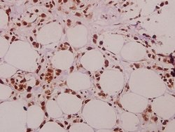 Invitrogen SFRS15 Polyclonal Antibody 100 &mu;L | Buy Online | Invitrogen&trade; | Fisher Scientific