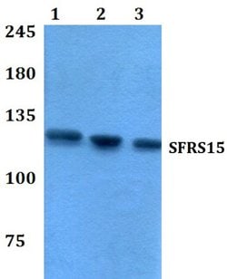 Invitrogen SFRS15 Polyclonal Antibody 100 &mu;L | Buy Online | Invitrogen&trade; | Fisher Scientific