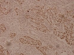Invitrogen ZP1 Polyclonal Antibody 100 &mu;L; Unconjugated:Antibodies,