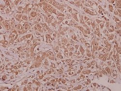 Invitrogen Phospho-AMPK alpha-1 (Ser486) Polyclonal Antibody 100 &mu;L;