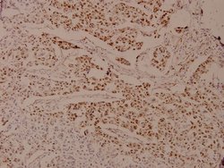 Invitrogen Phospho-Androgen Receptor (Ser650) Polyclonal Antibody 100 &mu;L;