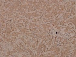 Invitrogen Phospho-ASK1 (Ser83) Polyclonal Antibody 100 &mu;L; Unconjugated:Antibodies,