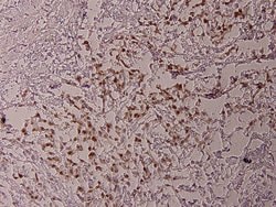 Phospho-ATF2 (Thr69) Polyclonal Antibody, Invitrogen 100 &mu;L; Unconjugated:Antibodies,