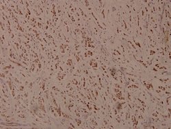 Phospho-ATF4 (Ser245) Polyclonal Antibody, Invitrogen&trade; 100 &mu;L; Unconjugated 