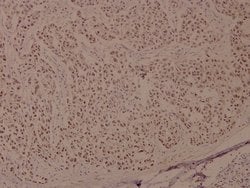 Invitrogen Phospho-BRCA1 (Ser1524) Polyclonal Antibody 100 &mu;L; Unconjugated:Antibodies,