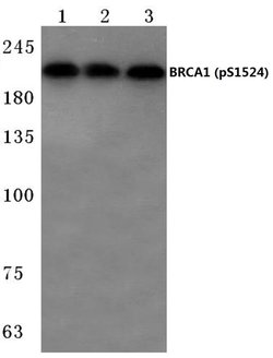 Invitrogen Phospho-BRCA1 (Ser1524) Polyclonal Antibody 100 &mu;L; Unconjugated:Antibodies,