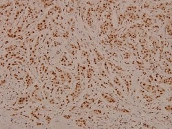 Invitrogen Phospho-C/EBP beta (Thr188, Thr235) Polyclonal Antibody 100