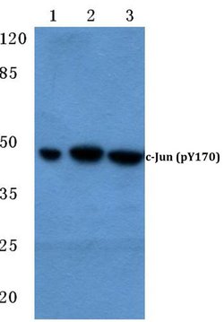 Phospho-c-Jun (Tyr170) Polyclonal Antibody:Antibodies, Polyclonal