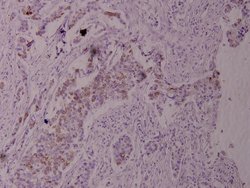 Invitrogen Phospho-TPL2 (Thr290) Polyclonal Antibody 100 &mu;L; Unconjugated:Antibodies,