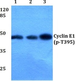 Invitrogen Phospho-Cyclin E (Thr395) Polyclonal Antibody 100 &mu;L; Unconjugated:Antibodies,