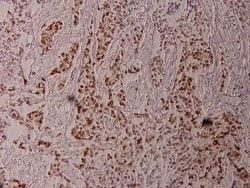 Invitrogen Phospho-ELK1 (Thr417) Polyclonal Antibody 100 &mu;L; Unconjugated:Antibodies,