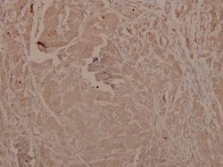 Invitrogen Phospho-GSK3 alpha/beta (Tyr279, Tyr216) Polyclonal Antibody