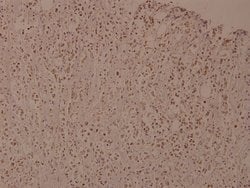 Invitrogen Phospho-IKK beta (Tyr188) Polyclonal Antibody 100 &mu;L; Unconjugated:Antibodies,