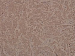 Invitrogen Phospho-JAK1 (Tyr1022) Polyclonal Antibody 100 &mu;L | Buy Online | Invitrogen&trade; | Fisher Scientific