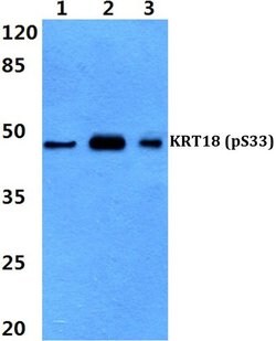 Phospho-Cytokeratin 18 (Ser33) Polyclonal Antibody:Antibodies, Polyclonal