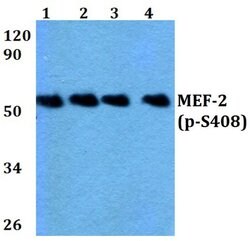 Invitrogen Phospho-MEF2A (Ser408) Polyclonal Antibody 100 &mu;L; Unconjugated:Anticuerpos