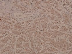 Phospho-MEF2A (Thr319) Polyclonal Antibody:Antibodies, Polyclonal