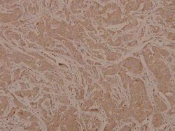 Invitrogen Phospho-MEK6 (Ser207) Polyclonal Antibody 100 &mu;L; Unconjugated:Antibodies,