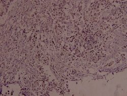 Invitrogen Phospho-c-Myc (Ser373) Polyclonal Antibody 100 &mu;L; Unconjugated:Antibodies,