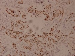 Phospho-c-Myc (Ser62) Polyclonal Antibody:Antibodies, Polyclonal