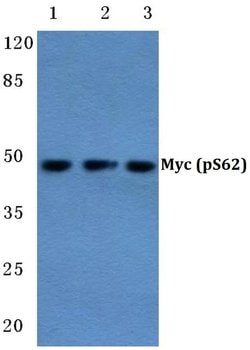 Phospho-c-Myc (Ser62) Polyclonal Antibody:Antibodies, Polyclonal
