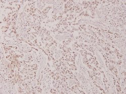 Invitrogen Phospho-c-Myc (Thr58) Polyclonal Antibody 100 &mu;L; Unconjugated:Antibodies,