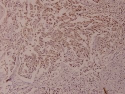Invitrogen Phospho-NFkB p100 (Ser866) Polyclonal Antibody 100 &mu;L; Unconjugated:Antibodies,