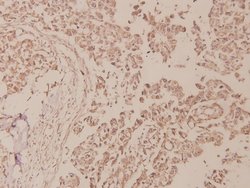 Invitrogen Phospho-NFkB p100 (Ser870) Polyclonal Antibody 100 &mu;L; Unconjugated:Antibodies,