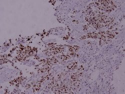 Invitrogen Phospho-STAT5 alpha (Ser780) Polyclonal Antibody 100 &mu;L;