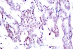 Invitrogen Phospho-STAT6 (Thr645) Polyclonal Antibody 100 &mu;L; Unconjugated:Antibodies,