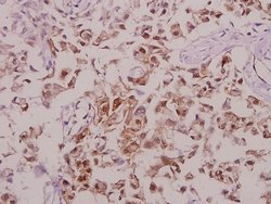 Invitrogen Phospho-Tyrosine Hydroxylase (Ser71) Polyclonal Antibody 100