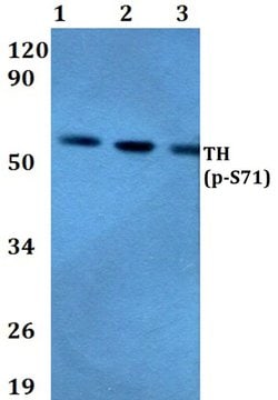 Invitrogen Phospho-Tyrosine Hydroxylase (Ser71) Polyclonal Antibody 100