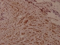 Invitrogen Phospho-WNK1 (Thr60) Polyclonal Antibody 100 &mu;L; Unconjugated:Antibodies,